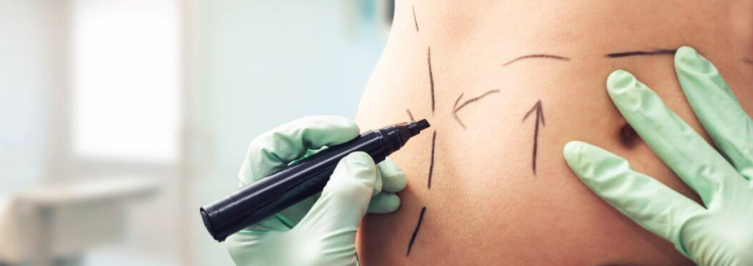 Quando Evitar a Cirurgia Plástica? Casos em que o Procedimento Não É Recomendado